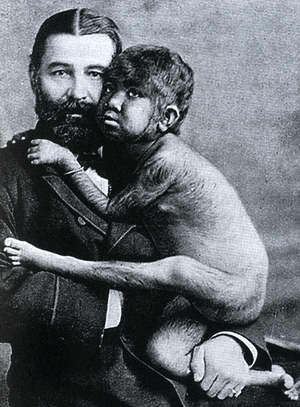 Slávna a roztomilá Krao bola vo svojej dobe skúmaná ako chýbajúci článok medzi opicou a človekom.